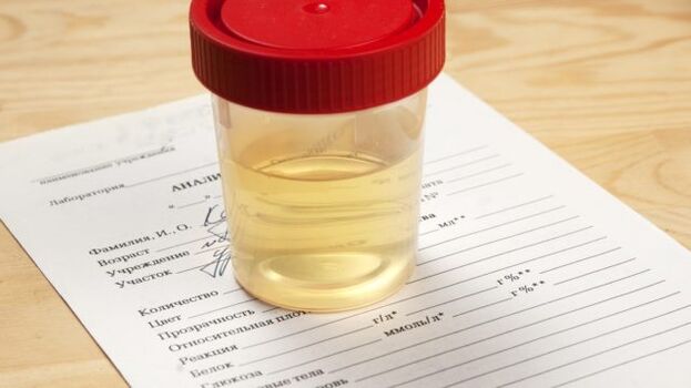 Analisi delle urine per ipertensione arteriosa